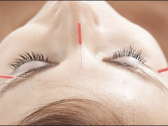 la-petite-clinique-ste-therese-acupuncture-2